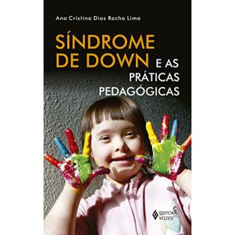 Síndrome de Down e as Práticas Pedagógicas - 1