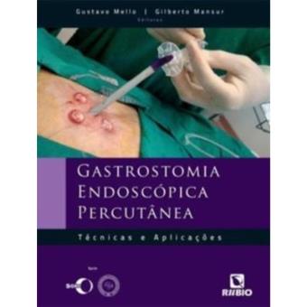 Gastrostomia Endoscópica Percutânea. Técnicas E Aplicações - 1