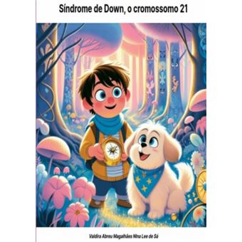 Síndrome De Down, O Cromossomo 21-Extra - 1