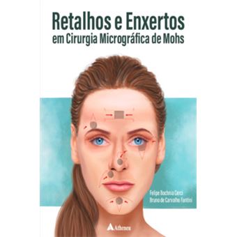 Retalhos E Enxertos Em Cirurgia Micrográfica De Mohs - 1