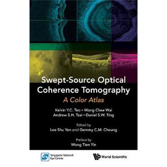 Swept-Source Optical Coherence Tomography - A Color Atlas - Paperback - 2015 - 1