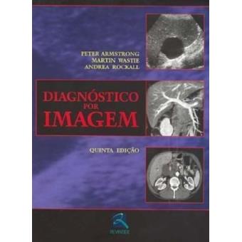 Extincao Do Desejo, A - Uma Historia De Iluminacao - 1