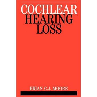 Cochlear Hearing Loss - Paperback - 1998 - 1