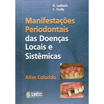 O Jipe Cangaceiro - 1