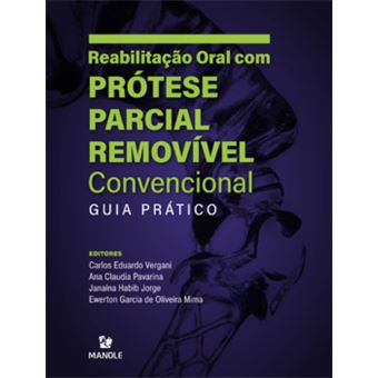 Reabilitação Oral Com Prótese Parcial Removível Convencional - 1
