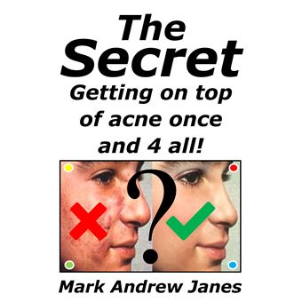 The Secret - Getting On Top Of Acne And Once And 4 All! - 1
