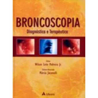 Broncoscopia Diagnostica e Terapêutica