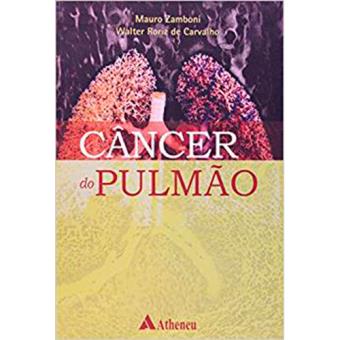 Câncer do Pulmão