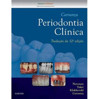 Carranza - Periodontia Clínica