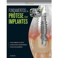 Fundamentos da Prótese Sobre Implantes