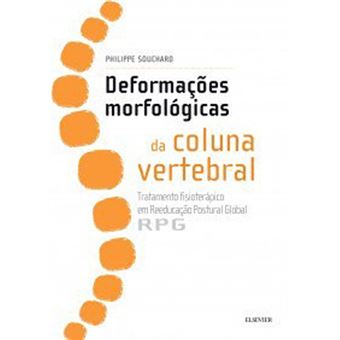 Deformações Morfológicas da Coluna Vertebral