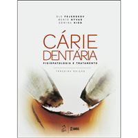 Cárie Dentaria: Fisiopatologia e Tratamento