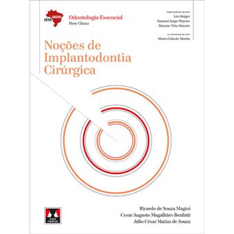 Série Abeno - Noções de Implantodontia Cirurgica