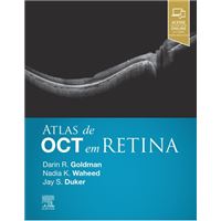 Atlas de Oct em Retina