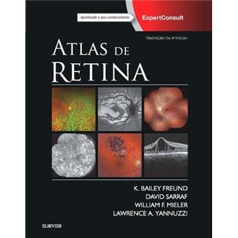 Atlas de Retina