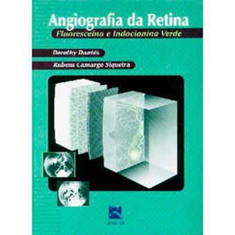 Angiografia da Retina