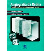 Angiografia da Retina