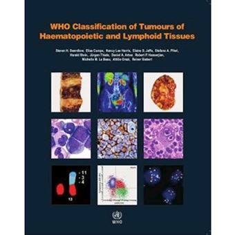 WHO classification of tumours of haematopoietic and lymphoid tissues ...