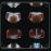 Neon Bible - 2LP 12''_0