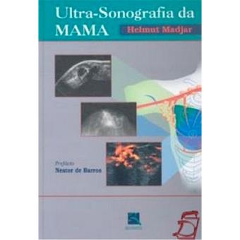 Ultra Sonografia Da Mama