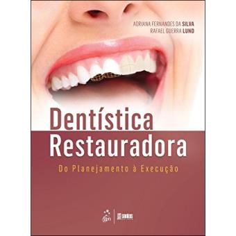 Dentística Restauradora - Do Planejamento à Execução