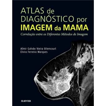 Atlas de Diagnóstico por Imagem de Mama