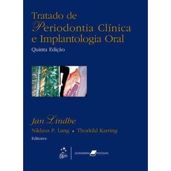 Tratado de Periodontia Clínica e Implantologia Oral