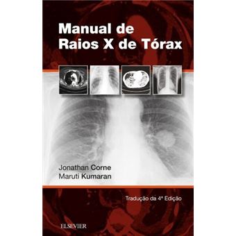 Manual de Raios-X de Tórax