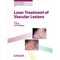 Laser Treatment of Vascular Lesions