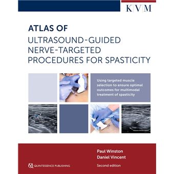 Atlas of Ultrasound-Guided Nerve-Targeted Procedures for Spasticity - 1
