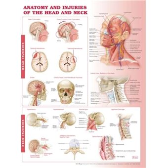 Anatomy and Injuries of the Head and Neck Anatomical Chart - broché ...