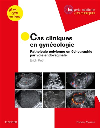 Cas cliniques en imagerie : gynécologie
