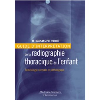 Guide d'interprétation de la radiographie thoracique de l'enfant : séméiologie normale et pathologique