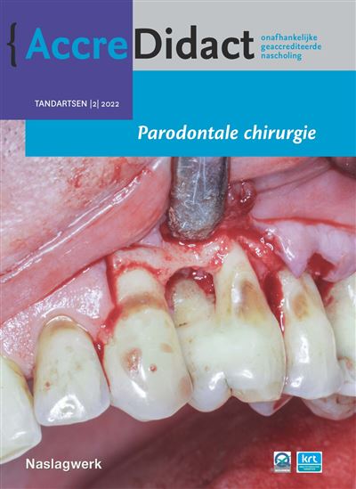 Parodontale chirurgie