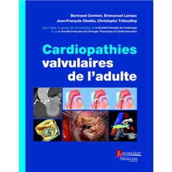Cardiopathies valvulaires de l'adulte