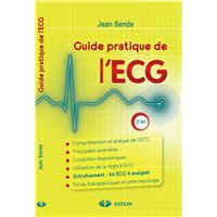 Guide pratique de l'ECG