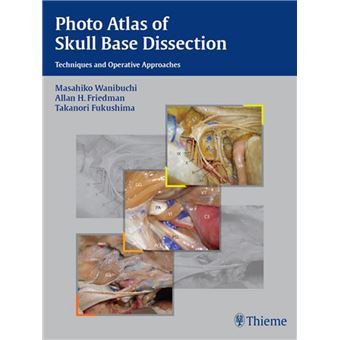 値下げPhoto Atlas of Skull Base Dissection Photo-Atlas-of-Skull-Base-