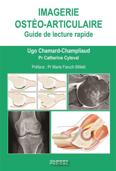 Imagerie osteo-articulaire - Hugo Chamard-Champliaud - broché