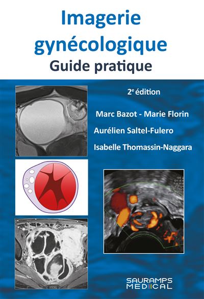 Imagerie gynécologique. Guide pratique 2ed - Marc Bazot - broché