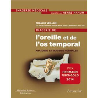 Imagerie de l'oreille et de l'os temporal - Volume 1. Anatomie et imagerie normales