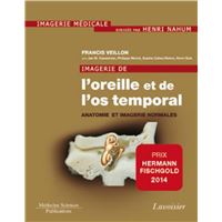 Imagerie de l'oreille et de l'os temporal - Volume 1. Anatomie et imagerie normales
