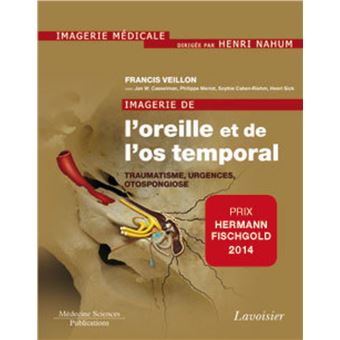 Imagerie de l'oreille et de l'os temporal - Volume 3. Traumatologie, urgences, otospongiose