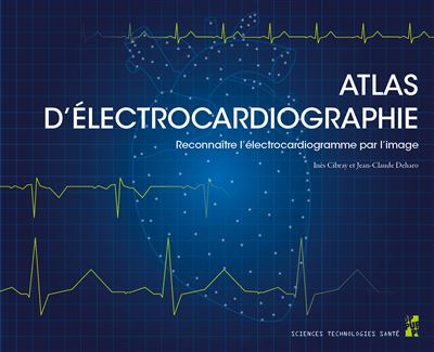 Reconnaître l’électrocardiogramme par l’image