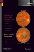 Pathologie vasculaire du fond d'oeil / Rétinopathie diabétique (volume 3 - coffret Rétine)