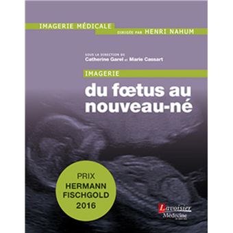 Imagerie : du foetus au nouveau-né