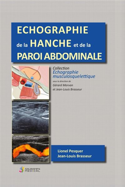 Echographie musculosquelettique