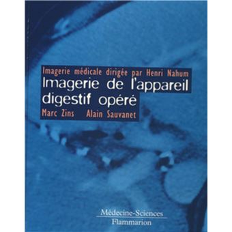 Imagerie de l'appareil digestif opéré