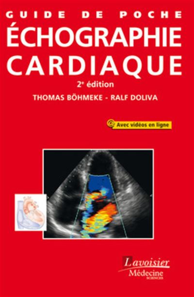 Guide de poche échographie cardiaque (2° Éd.)