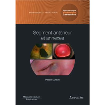 Segment antérieur et annexes. Volume 2 - Coffret Ophtalmologie pédiatrique et strabismes