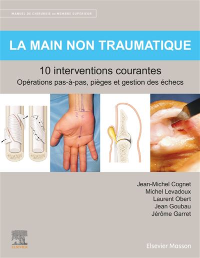 La main non traumatique 10 interventions courantes - Jean-Michel Cognet - broché